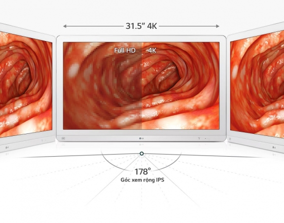 Đột Phá Công Nghệ Phòng Mổ Với Màn Hình Phẫu Thuật Nội Soi LG 32HL714S 4K UHD