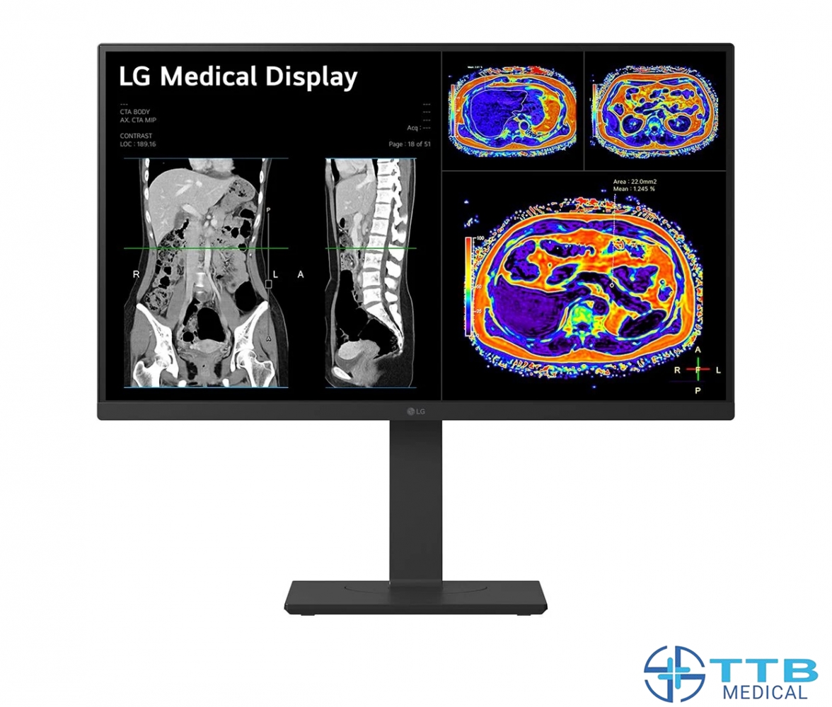27HS713C-MÀN HÌNH CHẨN ĐOÁN LÂM SÀNG